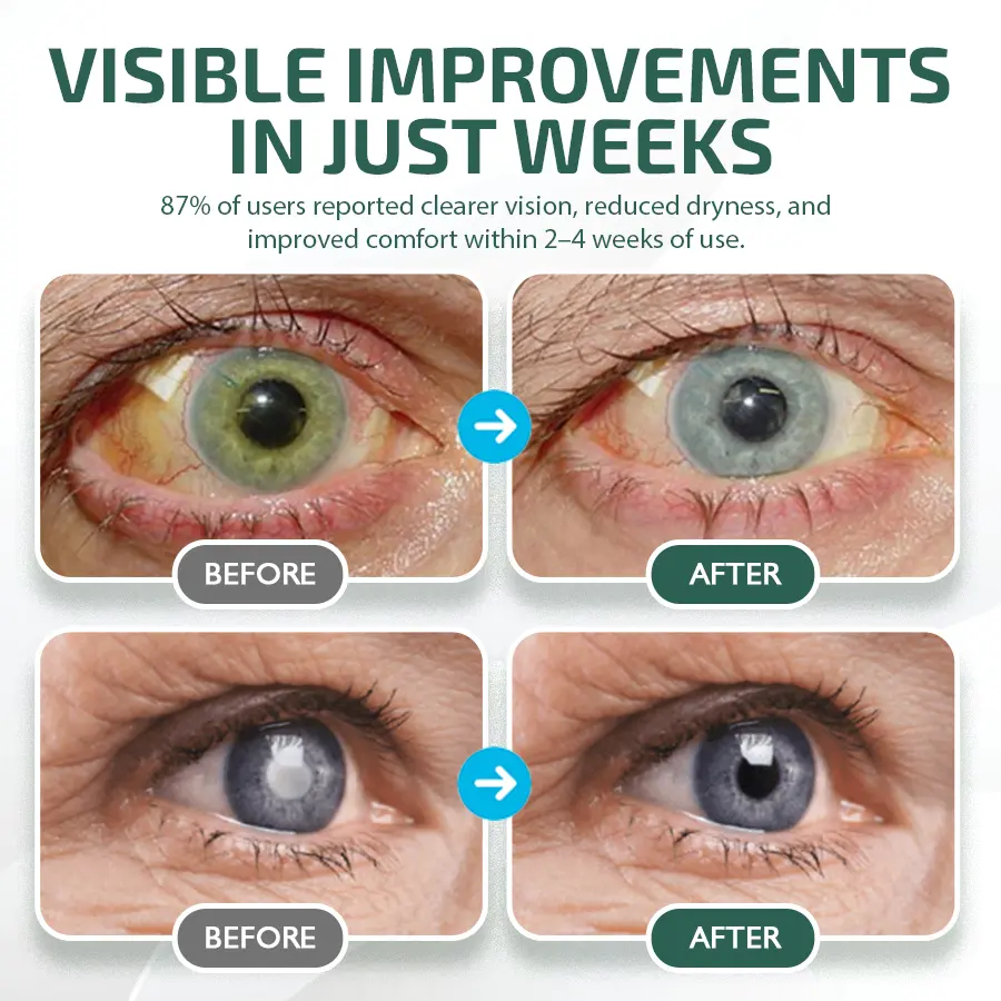 NEGUSY™ Nano Eye Drops Serum 👩⚕️ Royal College of Ophthalmologists Recommended (Suitable for presbyopia, dry eye syndrome, glaucoma, and cataracts)