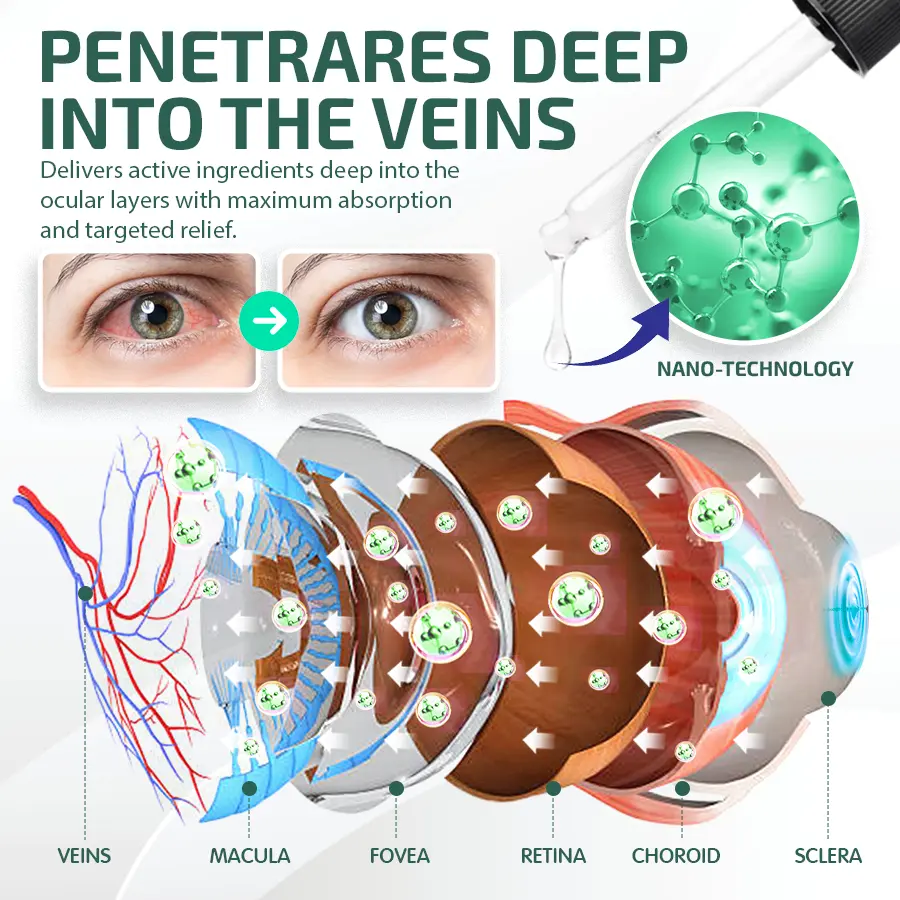NEGUSY™ Nano Eye Drops Serum 👩⚕️ Royal College of Ophthalmologists Recommended (Suitable for presbyopia, dry eye syndrome, glaucoma, and cataracts)
